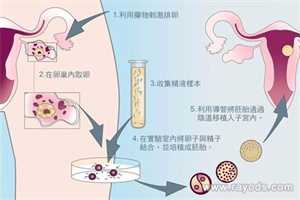 天津助孕的服务态度,2022天津中心妇产医院试管婴儿医生名单（附助孕成功率）